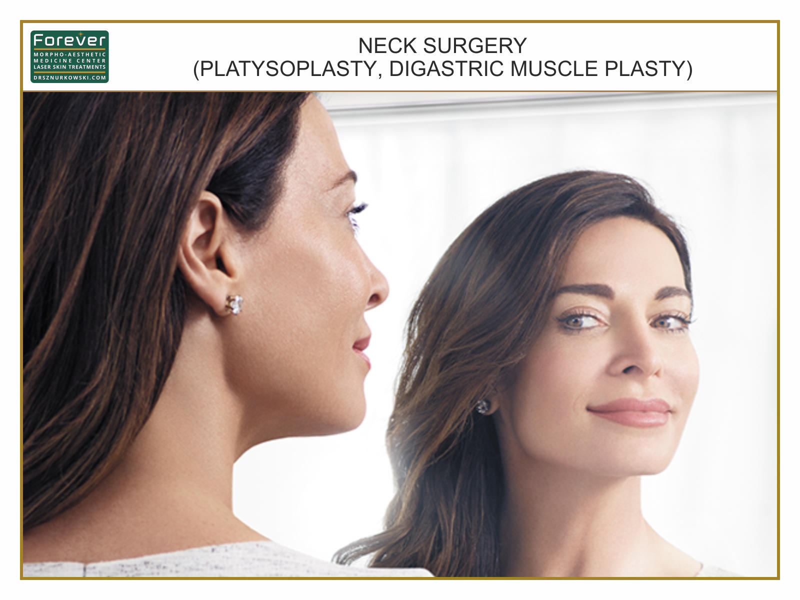 Neck Surgery (Platysoplasty, Digastric Muscle Plasty), (80x60) EN.jpg