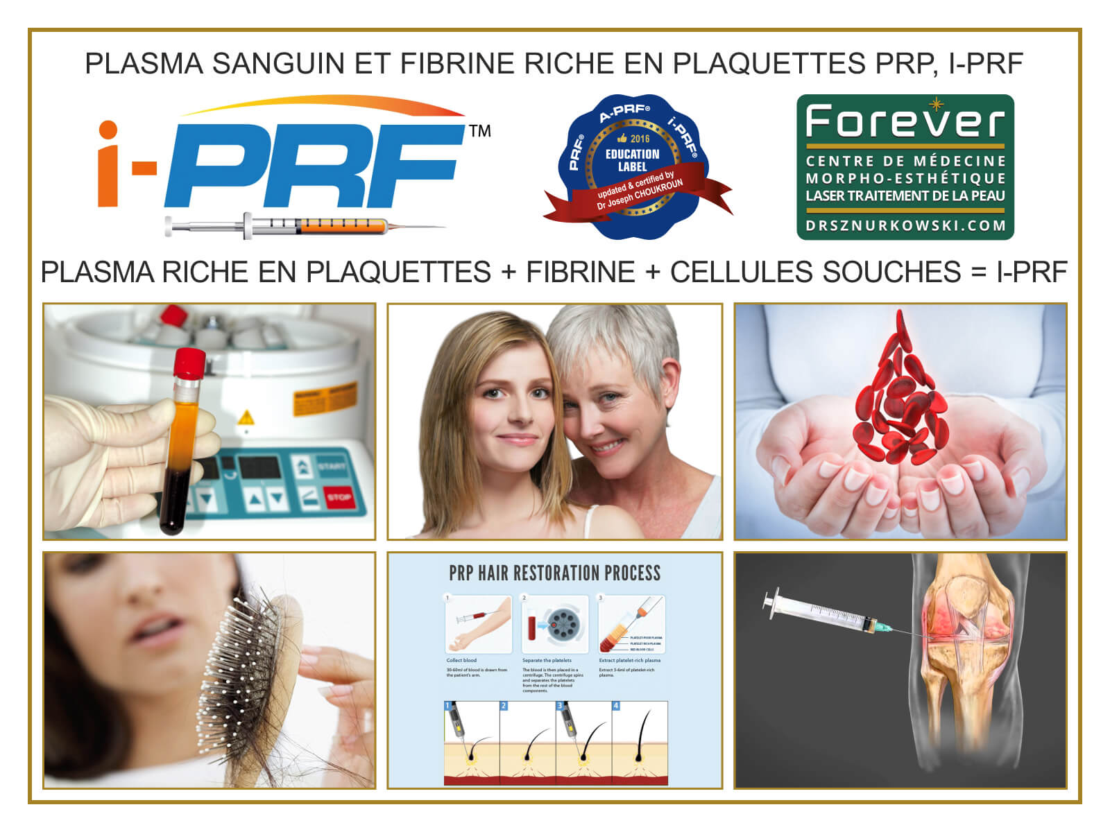 New Generation of Platelet Rich Plasma (80x60) FR.jpg