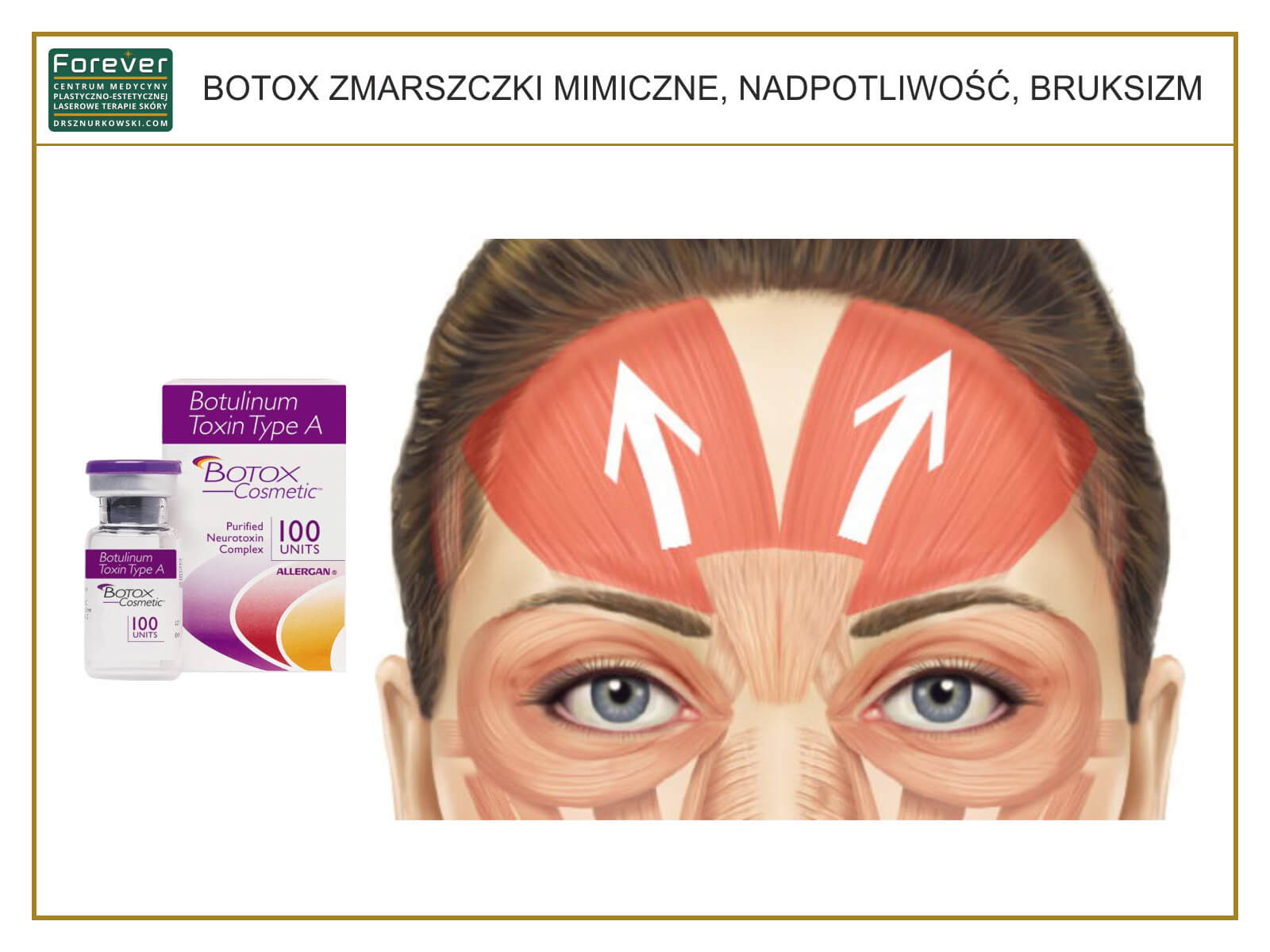 Botox - Expression Wrinkles, Excessive Sweating (80x60) PL.jpg