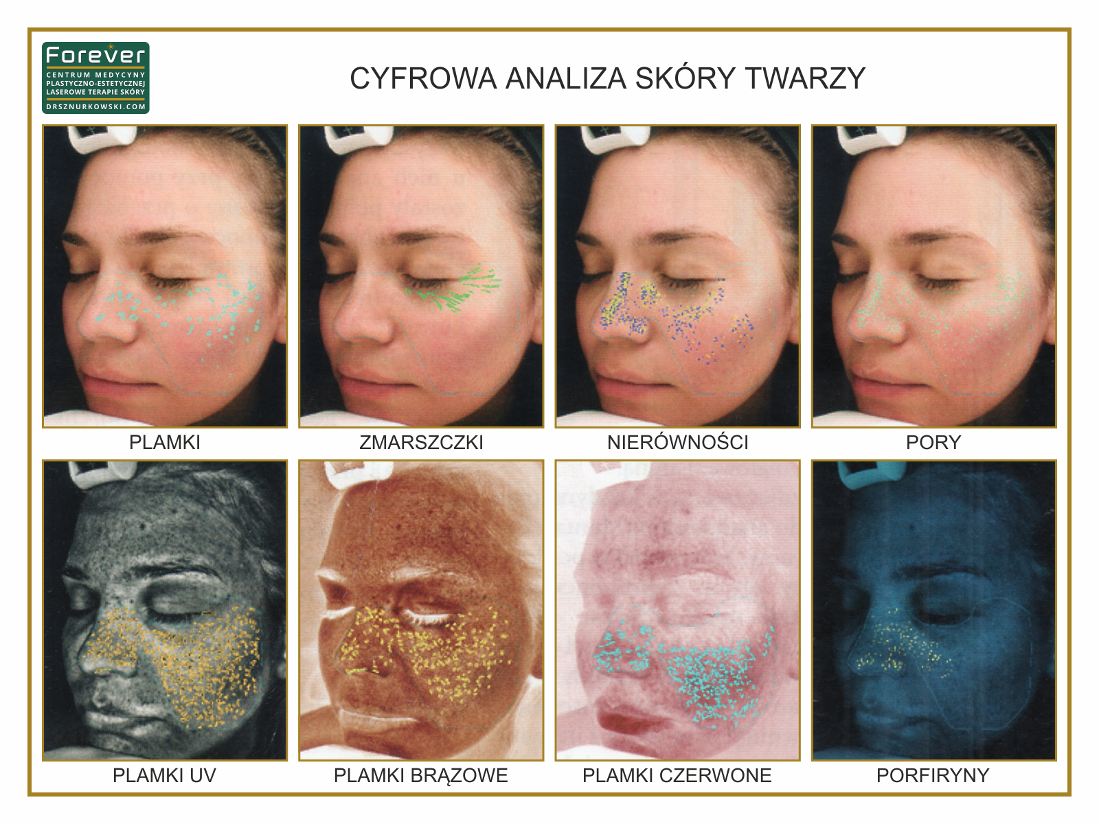 Digital Skin Complexion Analysis (80x60) PL.jpg