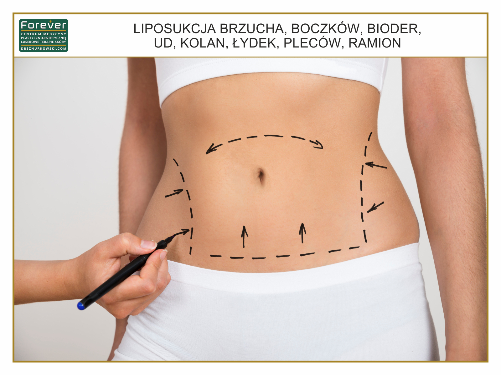 Liposukcja brzucha, boczkow, bioder, ud, kolan, lydek, plecow, ramion.jpg