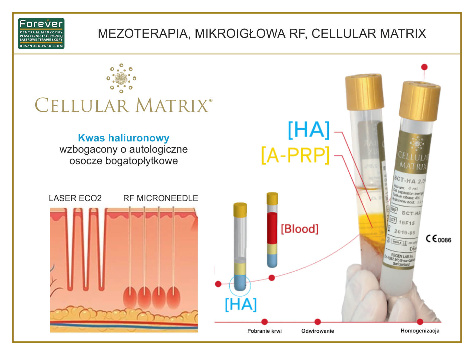 Mesotherapy, RF Microneedle, Cellular Matrix (80x60) PL.jpg