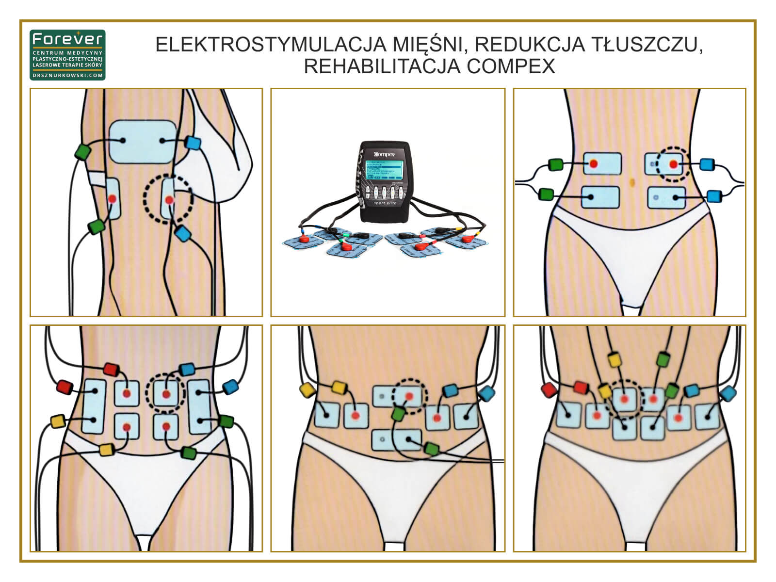 Muscle Electrostimulation, Fat Reduction, Compex Rehabilitation (80x60) PL.jpg